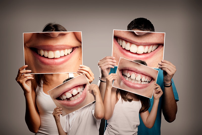 Four People Holding Image of their Teeth — Dentist in Palm Beach, QLD