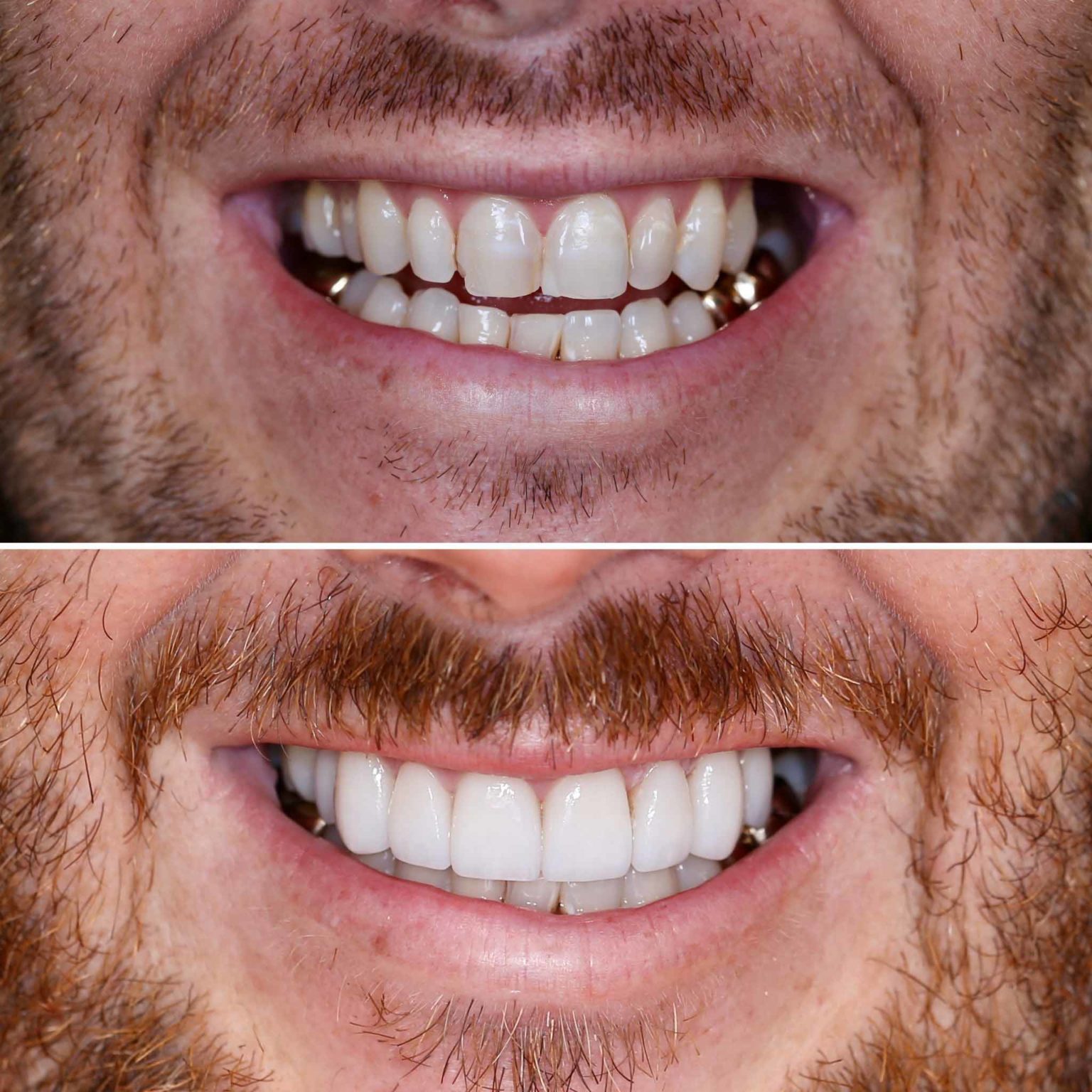 51 Tooth Dental Haus:  A Patient'S Honest Review - f8jzhde