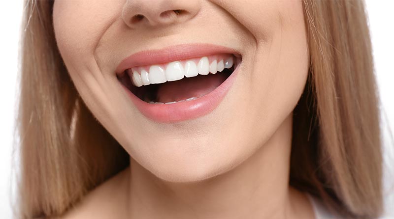 A Woman with Perfect Teeth — Dentist in Palm Beach, QLD