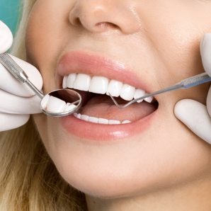 Woman Being Dental Checked in Palm Beach