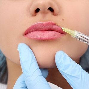 Procedure in Beauty Clinic Filler Injection — Dentist in Palm Beach, QLD