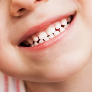 White Teeth Of A Child — Dentist in Palm Beach, QLD