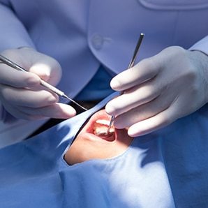 Mouth Restoration Procedure — Dentist in Palm Beach, QLD
