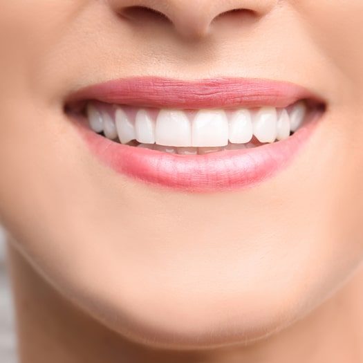 Young Beautiful Woman With Healthy Teeth — Dentist in Palm Beach, QLD
