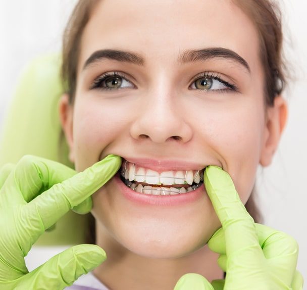 Orthodontic Brace Control — Dentist in Palm Beach, QLD
