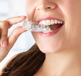 A woman putting in clear aligners after an Orthodontic appointment at our Dentist in Palm Beach