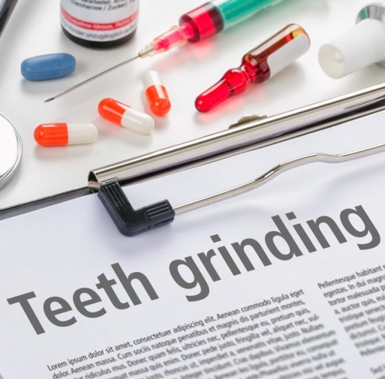 Diagnosis of Teeth Grinding — Dentist in Palm Beach, QLD